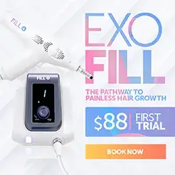 Exo-fill Therapy at $88 Only